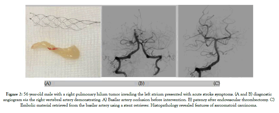 vascular-medicine-surgery-56 year-old male